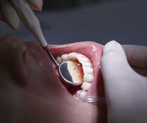 Revisión dental